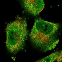CGI-16 Antibody, Novus Biologicals 25 &mu;L; Unlabeled:Antibodies, Polyclonal